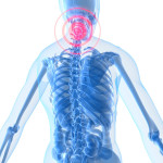 首から肩の痛み