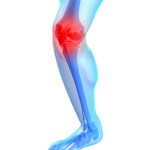 右膝の痛み